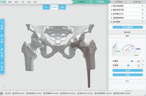3d打印人體骨骼 這家哈佛大學孵化的公司要為中國醫(yī)生開發(fā)自己的軟件平臺...